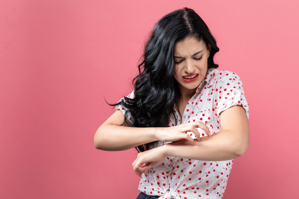 Treating Eczema