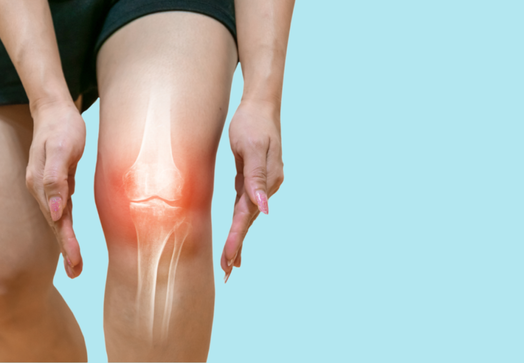 4 Natural Remedies For Osteoarthritis Management 1